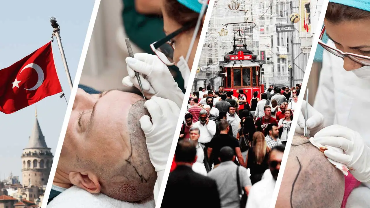 Why Turkey is the Best Destination for Hair Transplant